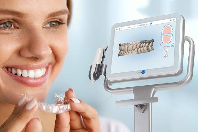CLEAR ALIGNERS